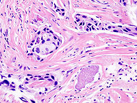 Anatomic Pathology