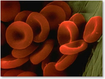 Hematopathology